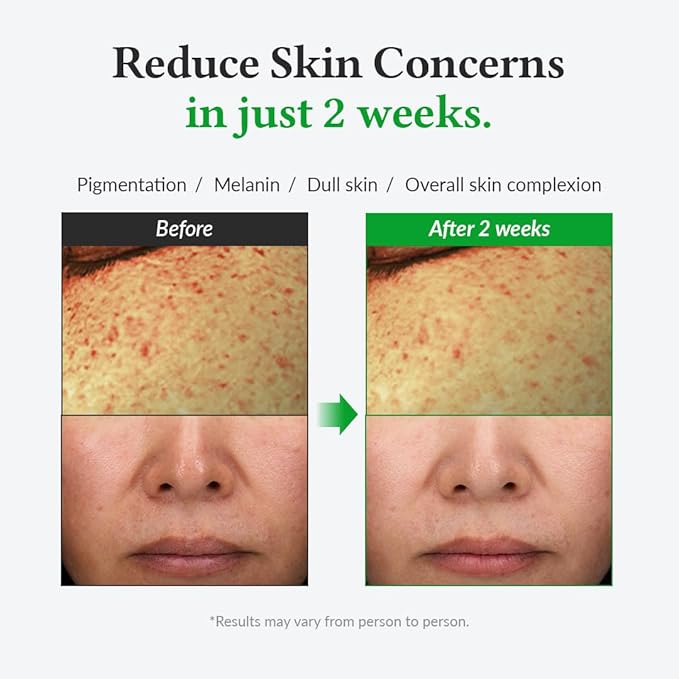 Dr.Althea 20% Gentle Vitamin C Serum