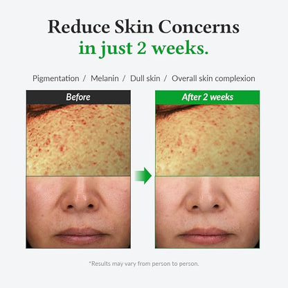 Dr.Althea 20% Gentle Vitamin C Serum